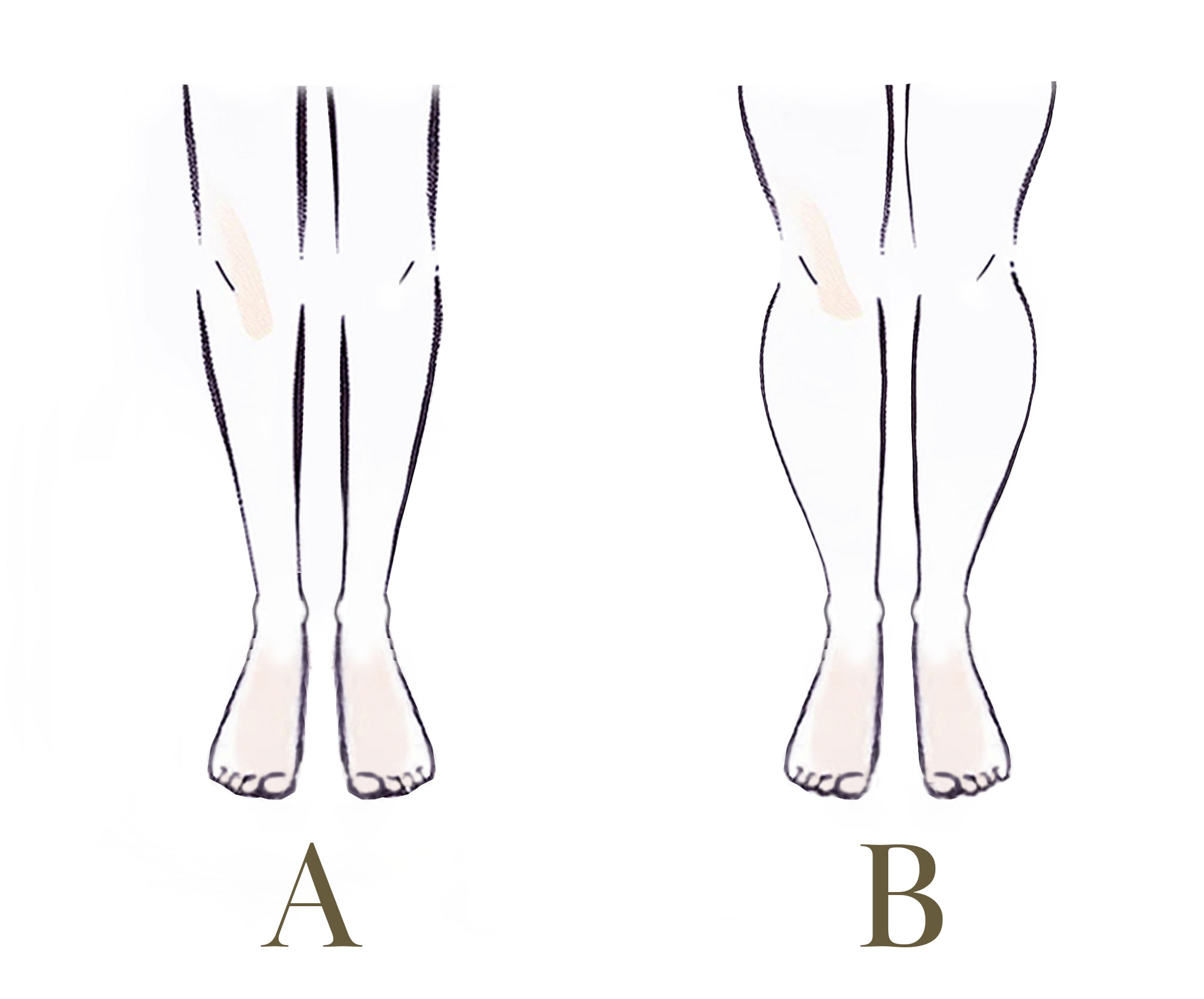 足の形